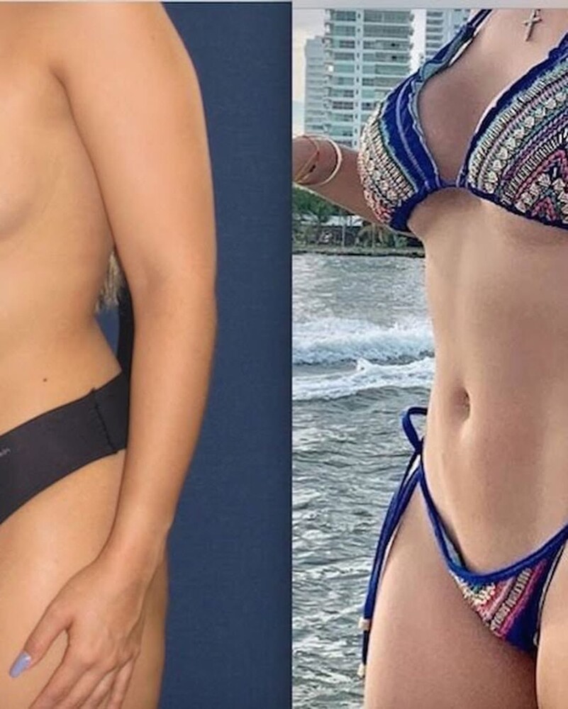 Before and After Result